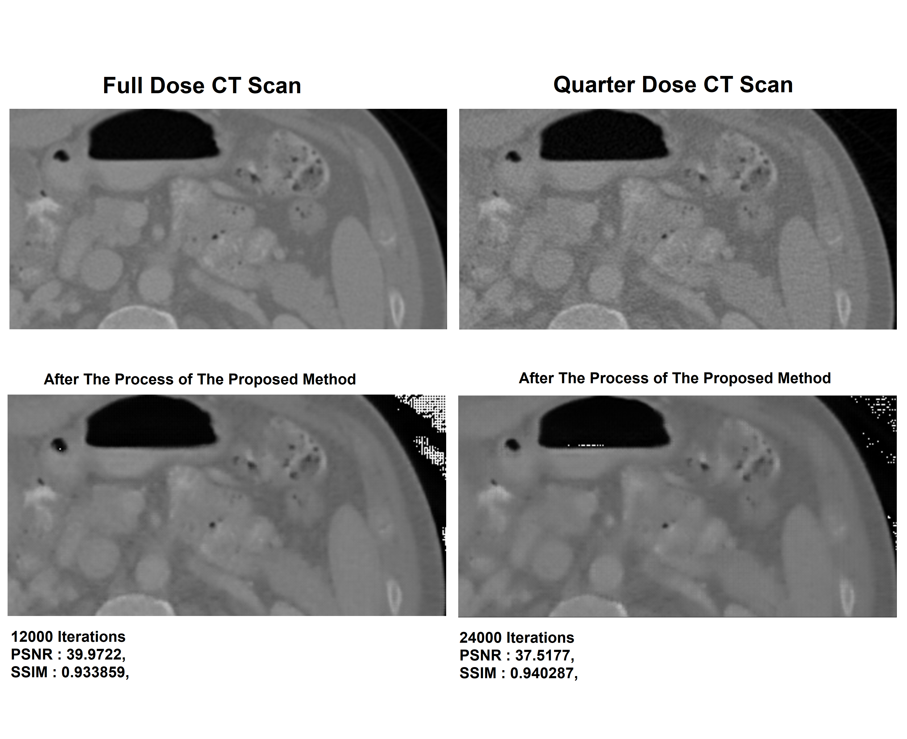 Example CT denoising results