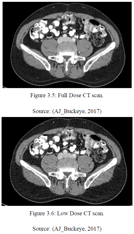 Low-dose and full-dose CT comparison