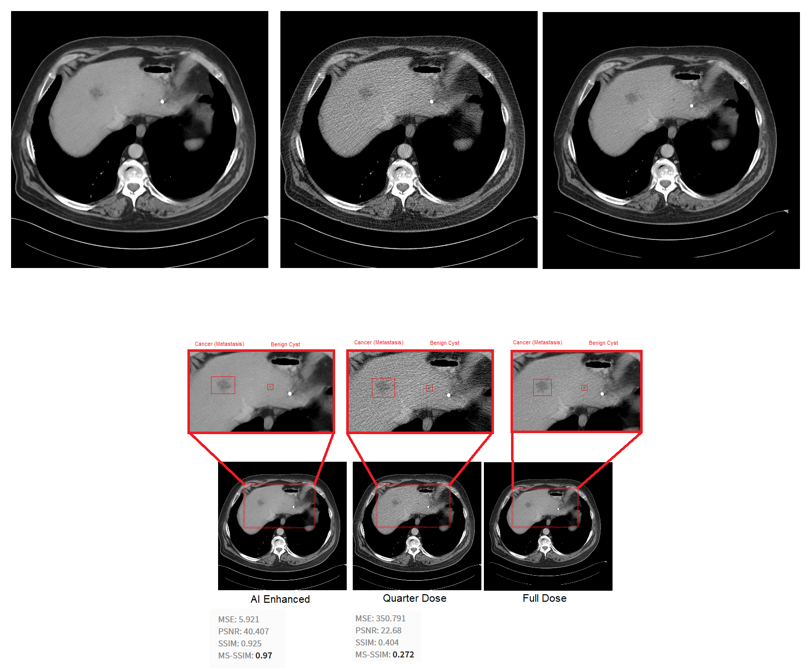 Quantitative comparison of denoising results